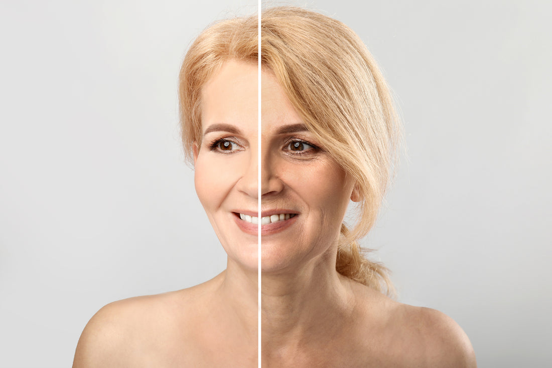 The Battle of the Aesthetics Titans: Co2 Laser vs. Morpheus 8 Micro needling