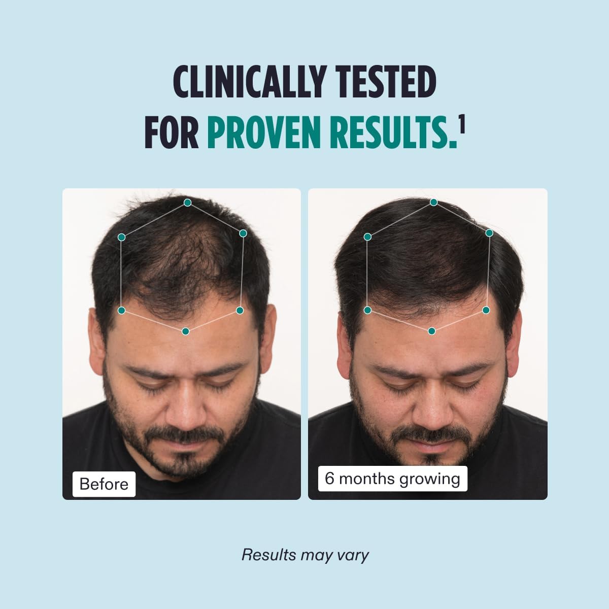 Nutrafol Men’s Hair Growth Supplements – Clinically Proven for Thicker, Stronger Hair - NOT THE VEGAN VERSION-