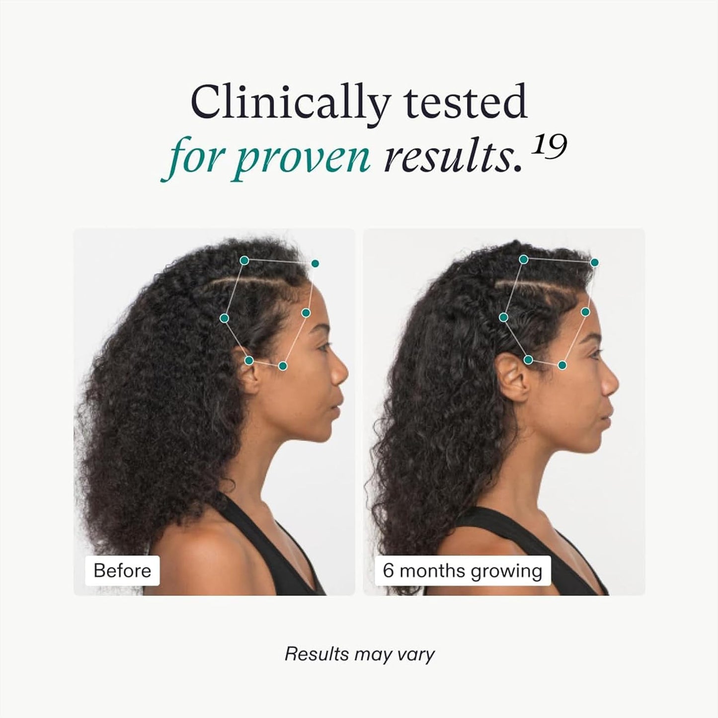 Nutrafol Women's Hair Growth Supplements, For Women 18-44 Years Old, Clinically Tested for Visibly Thicker, Stronger Hair, Dermatologist Recommended NOT THE VEGAN VERSION-