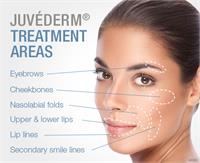 Dermal Filler Juvederm Voluma