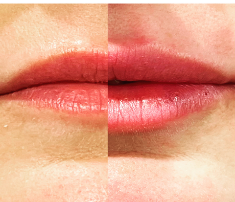 Mini Lip Plump