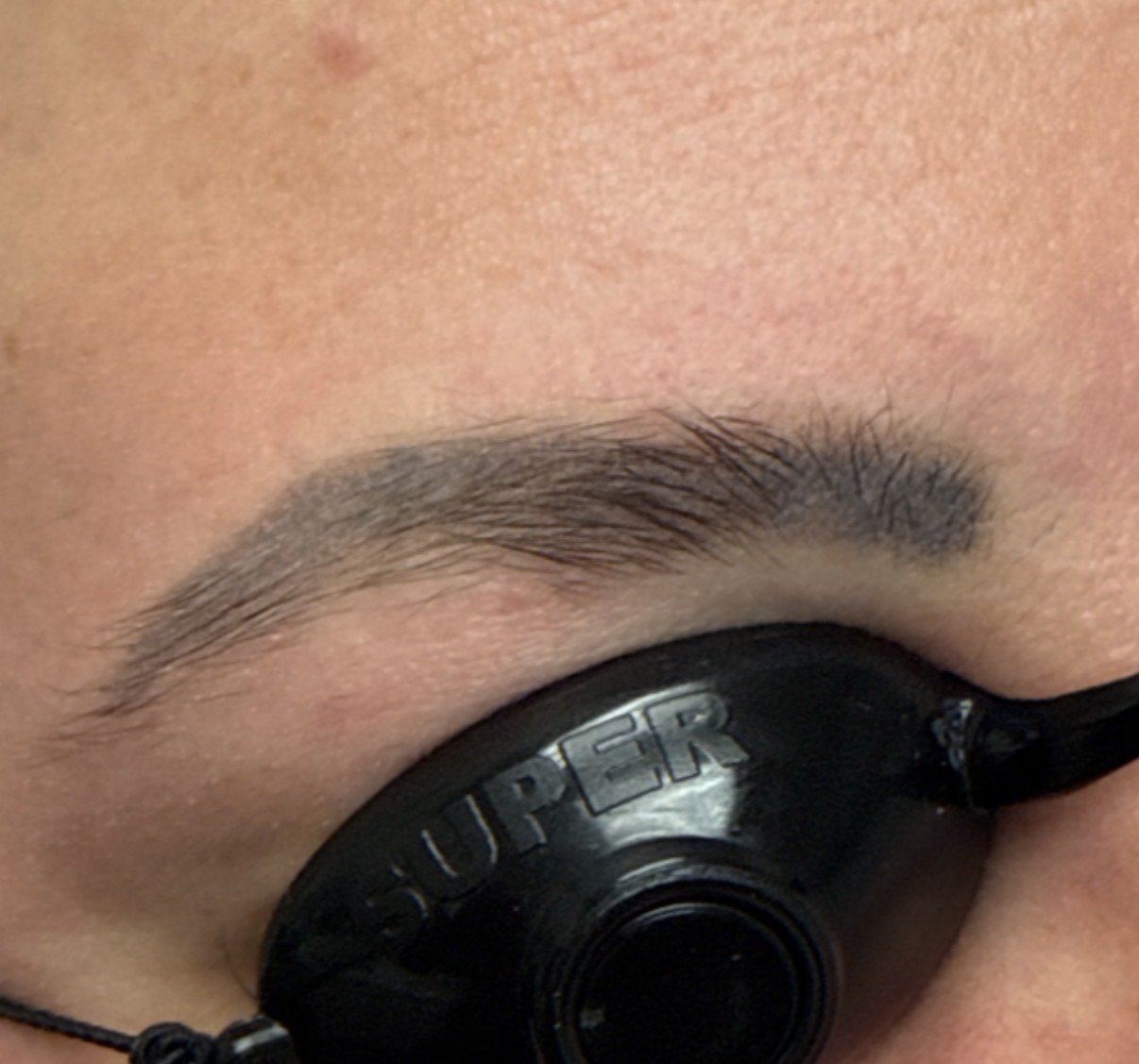Laser tattoo removal fading after 3-4 TORO treatments at Reflections