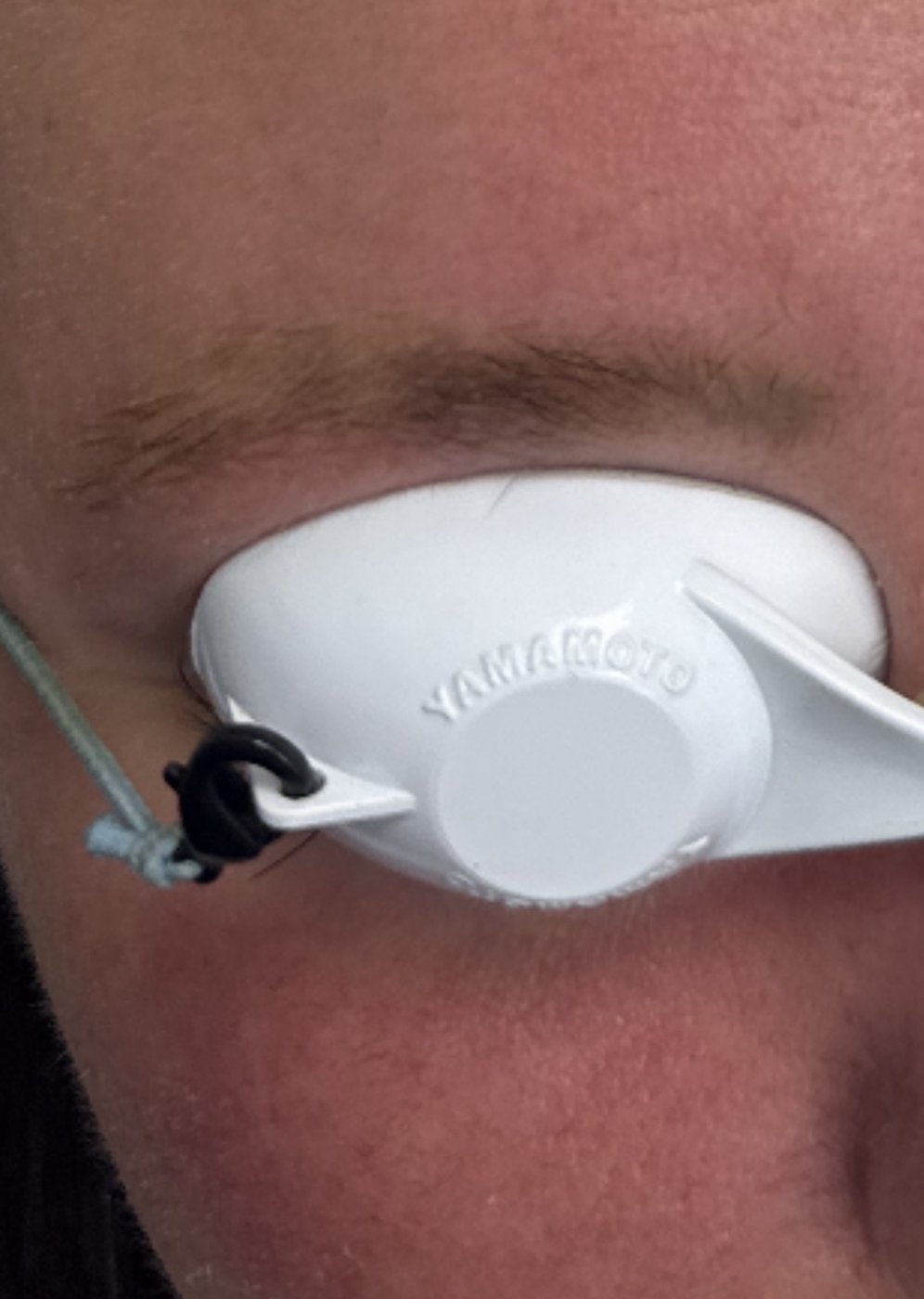 Laser tattoo removal fading after 3-4 TORO treatments at Reflections